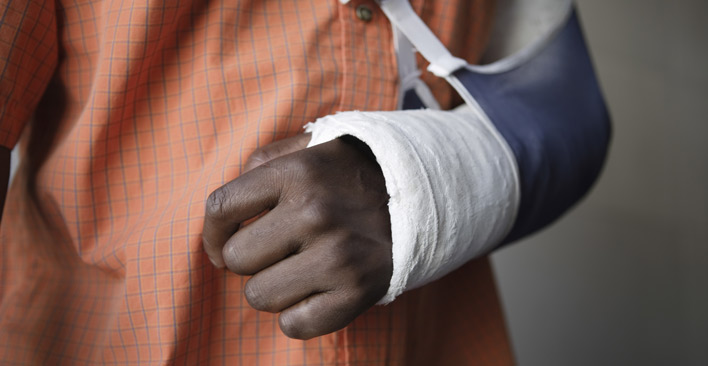 broken bone